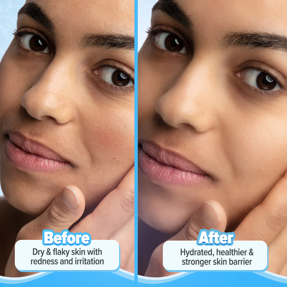Freebie - 5 Barrier+ Repair Moisturizer with Avocado & 5 Essential Ceramides - 100g - Image 7
